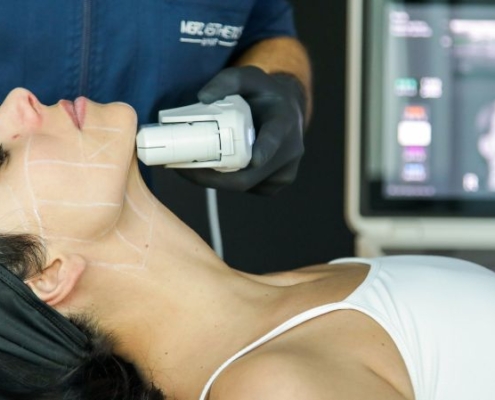 Lifting non invasivo per viso, collo e décolleté